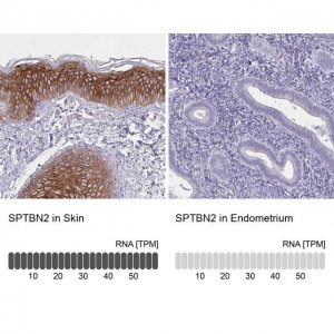 Anti-SPTBN2 antibody produced in rabbit 