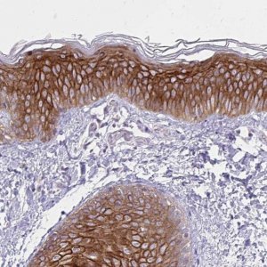 Anti-SPTBN2 antibody produced in rabbit 