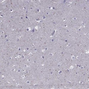 Anti-SPTBN4 antibody produced in rabbit 