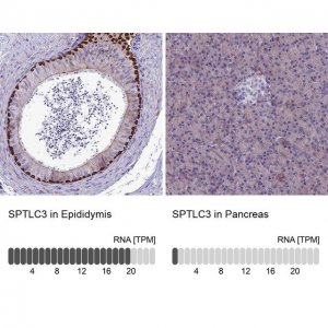 Anti-SPTLC3 antibody produced in rabbit 