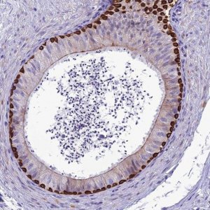 Anti-SPTLC3 antibody produced in rabbit 