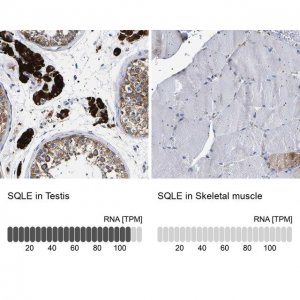 Anti-SQLE antibody produced in rabbit 