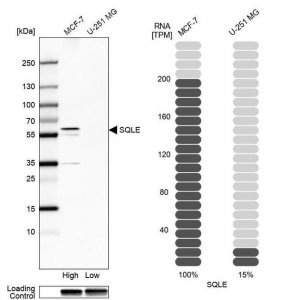 Anti-SQLE antibody produced in rabbit 