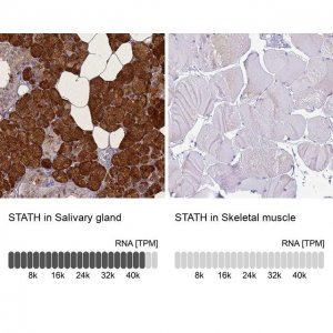 Anti-STATH antibody produced in rabbit 