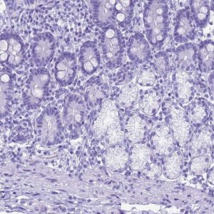 Anti-STATH antibody produced in rabbit 