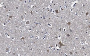 Anti-Stathmin-2 Antibody, clone 1B3 ZooMAb Rabbit Monoclonal 