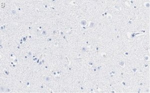 Anti-Stathmin-2 Antibody, clone 1B3 ZooMAb Rabbit Monoclonal 