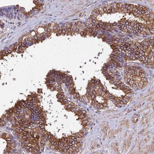 Anti-STC2 antibody produced in rabbit 