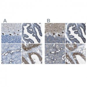 Anti-STIM1 antibody produced in rabbit 