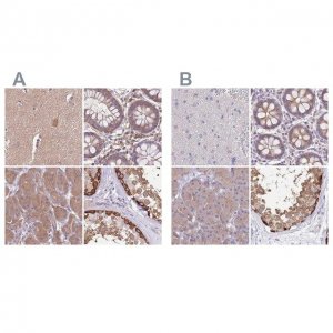 Anti-STIP1 antibody produced in rabbit 