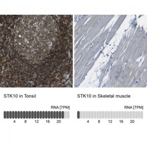 Anti-STK10 antibody produced in rabbit HPA015083-100UL