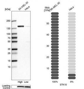 Anti-STK10 antibody produced in rabbit HPA015083-100UL