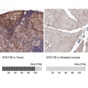 Anti-STK17B antibody produced in rabbit 