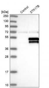 Anti-STK17B antibody produced in rabbit 