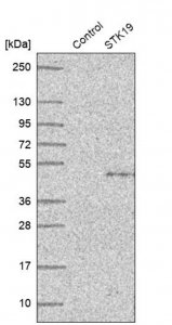 Anti-STK19 antibody produced in rabbit 