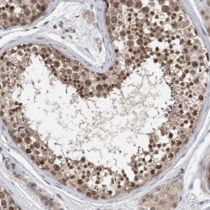 Anti-STK19 antibody produced in rabbit 