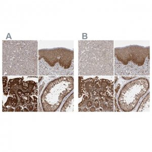 Anti-STK24 antibody produced in rabbit 