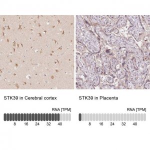 Anti-STK39 antibody produced in rabbit 