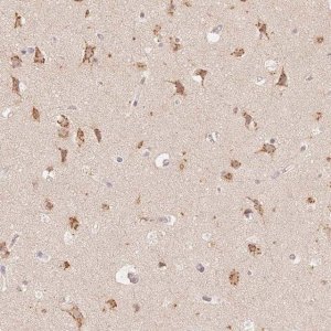 Anti-STK39 antibody produced in rabbit 