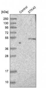 Anti-STK40 antibody produced in rabbit HPA008026-100UL