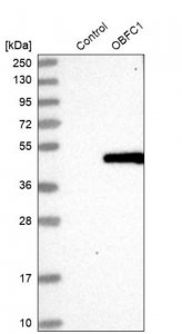 Anti-STN1 antibody produced in rabbit HPA037925-100UL