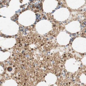 Anti-STOM antibody produced in rabbit HPA010961-100UL