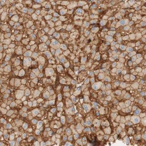 Anti-STOM antibody produced in rabbit HPA010961-100UL
