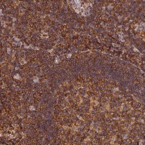 Anti-STOML1 antibody produced in rabbit 