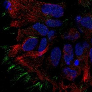 Anti-STOML3 antibody produced in rabbit 
