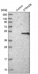 Anti-STRADB antibody produced in rabbit 