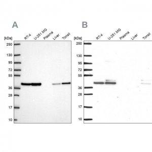 Anti-STRAP antibody produced in rabbit 
