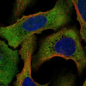 Anti-STRAP antibody produced in rabbit 