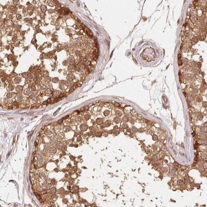 Anti-STRN4 antibody produced in rabbit 