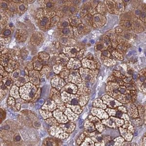 Anti-STUB1 antibody produced in rabbit 