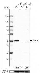 Anti-STX16 antibody produced in rabbit 