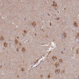Anti-STX16 antibody produced in rabbit 
