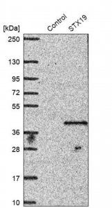 Anti-STX19 antibody produced in rabbit 
