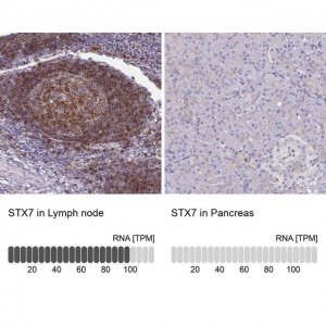 Anti-STX7 antibody produced in rabbit 