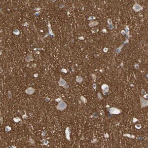 Anti-STXBP1 antibody produced in rabbit HPA008209-100UL