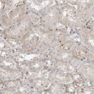 Anti-STXBP3 antibody produced in rabbit HPA027225-100UL