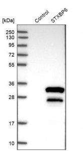 Anti-STXBP6 antibody produced in rabbit 