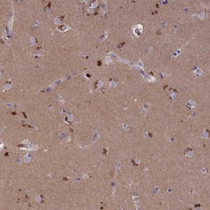 Anti-STYX antibody produced in rabbit 