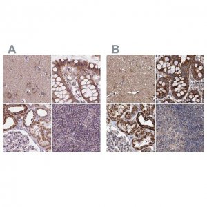 Anti-SUCLA2 antibody produced in rabbit 