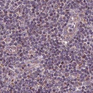 Anti-SUCLA2 antibody produced in rabbit 