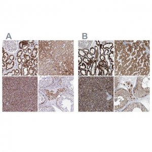 Anti-SUCLG2 antibody produced in rabbit 