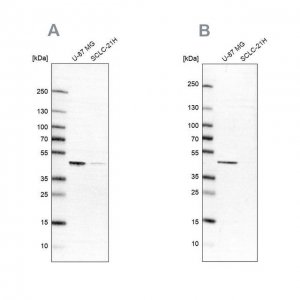 Anti-SUCLG2 antibody produced in rabbit 