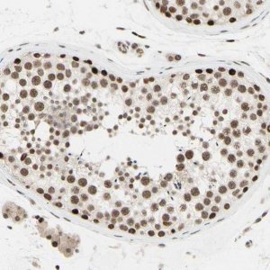 Anti-SUFU antibody produced in rabbit HPA008700-100UL