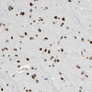 Anti-SUFU antibody produced in rabbit HPA008700-100UL