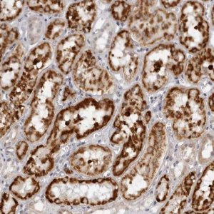 Anti-SUGCT antibody produced in rabbit 