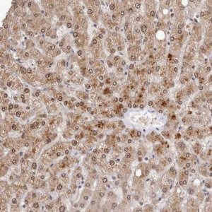 Anti-SULT1E1 antibody produced in rabbit HPA028213-100UL